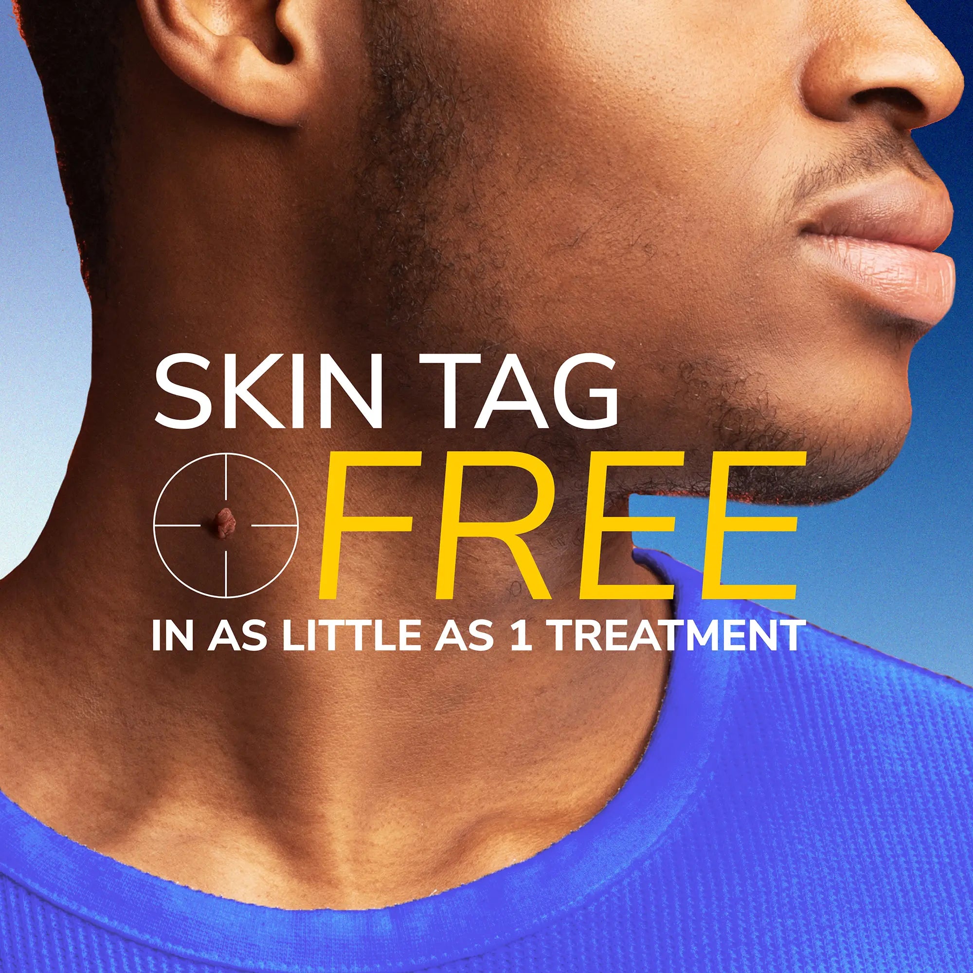 Freeze Away  Skin Tag Remover - Image 3